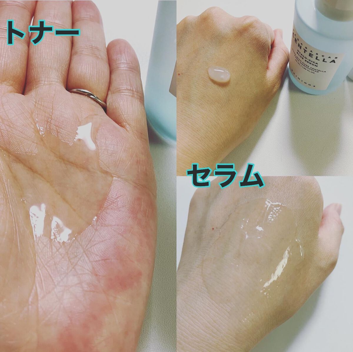 ヒアルーシカ ブライトニングトナー/SKIN1004/化粧水を使ったクチコミ（2枚目）