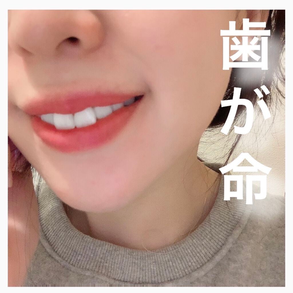 シュミテクト高濃度フッ素配合優しくホワイトニングEX/シュミテクト/歯磨き粉を使ったクチコミ(1枚目)