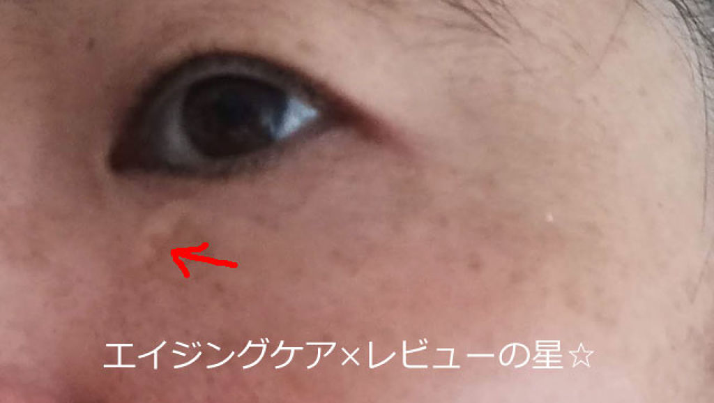 モイスチャー サージ 96 アイ コンセントレート/CLINIQUE/アイケア・アイクリームを使ったクチコミ（3枚目）