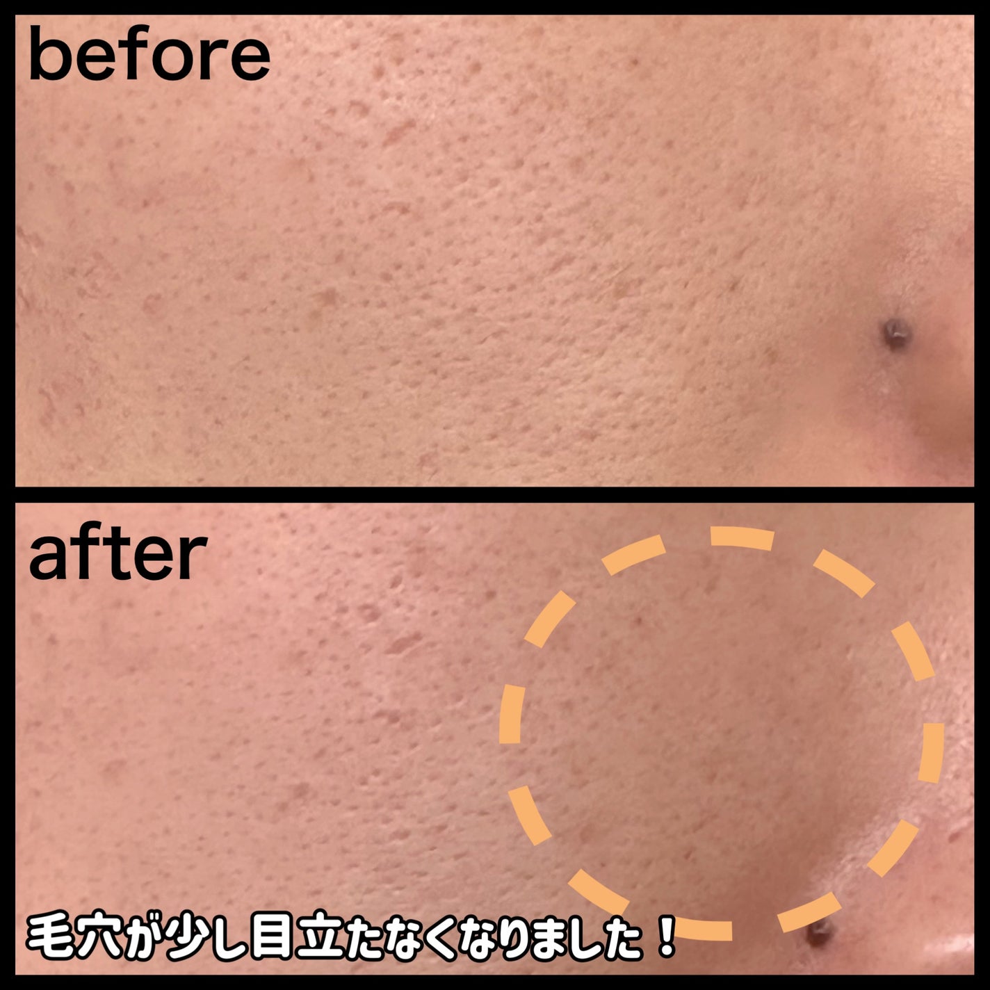 アルティミューン パワライジング コンセントレート Ⅲn/SHISEIDO/美容液を使ったクチコミ(3枚目)