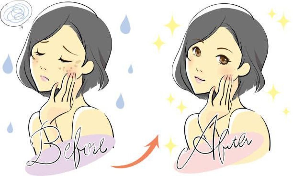 オードムーゲ 薬用ローション（ふきとり化粧水）/オードムーゲ/拭き取り化粧水を使ったクチコミ（1枚目）