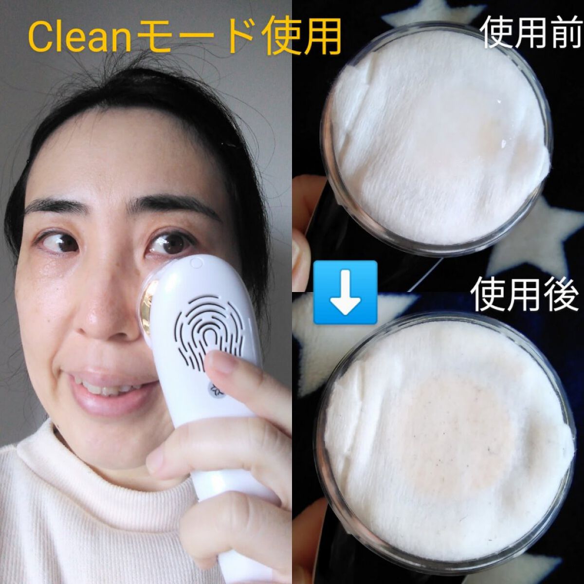 多機能温冷美顔器/ANLAN/美顔器・マッサージを使ったクチコミ(6枚目)