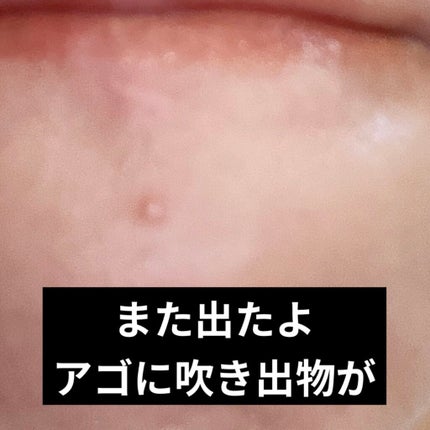 モイスチャーピックアップマスク PRO HYAL SHOT/Dermatory/その他スキンケアを使ったクチコミ(3枚目)