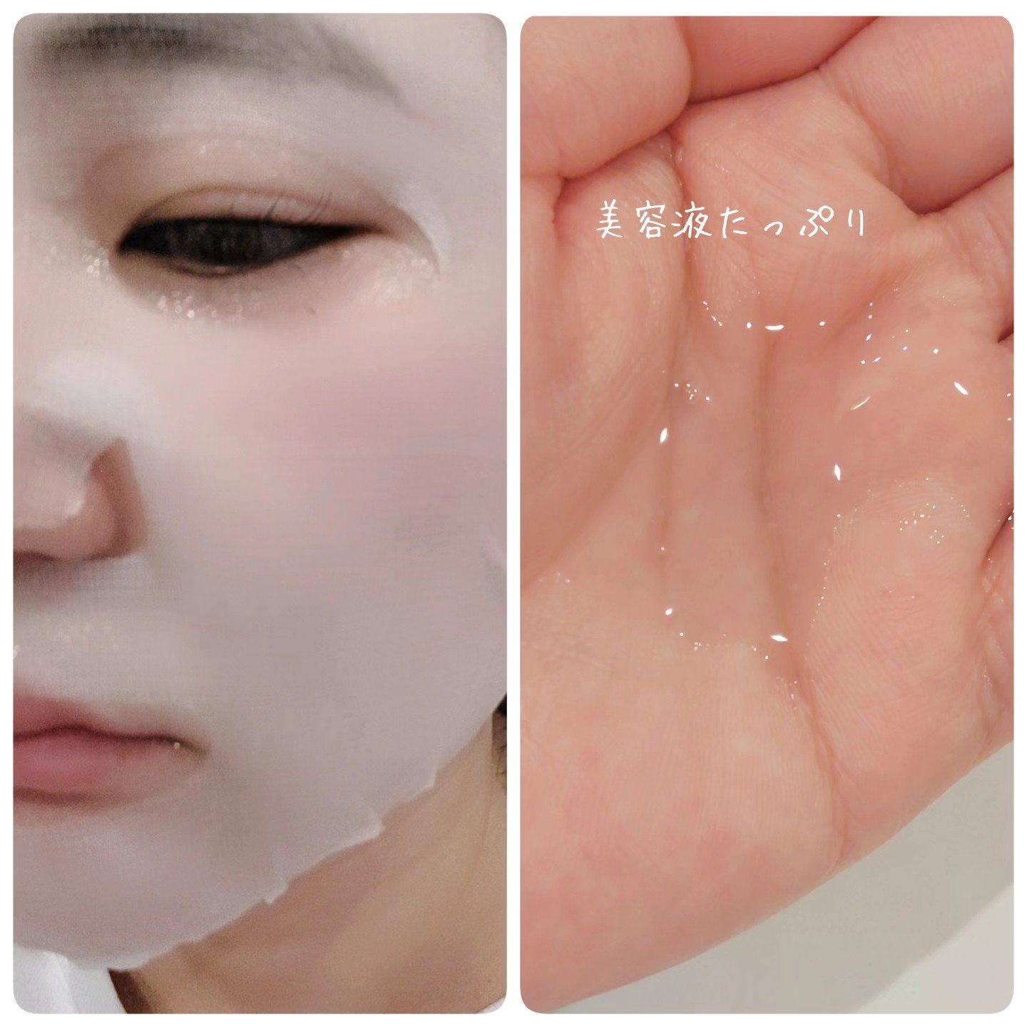 ブルーブライトマスク/EMROSÉ/シートマスク・パックを使ったクチコミ（3枚目）