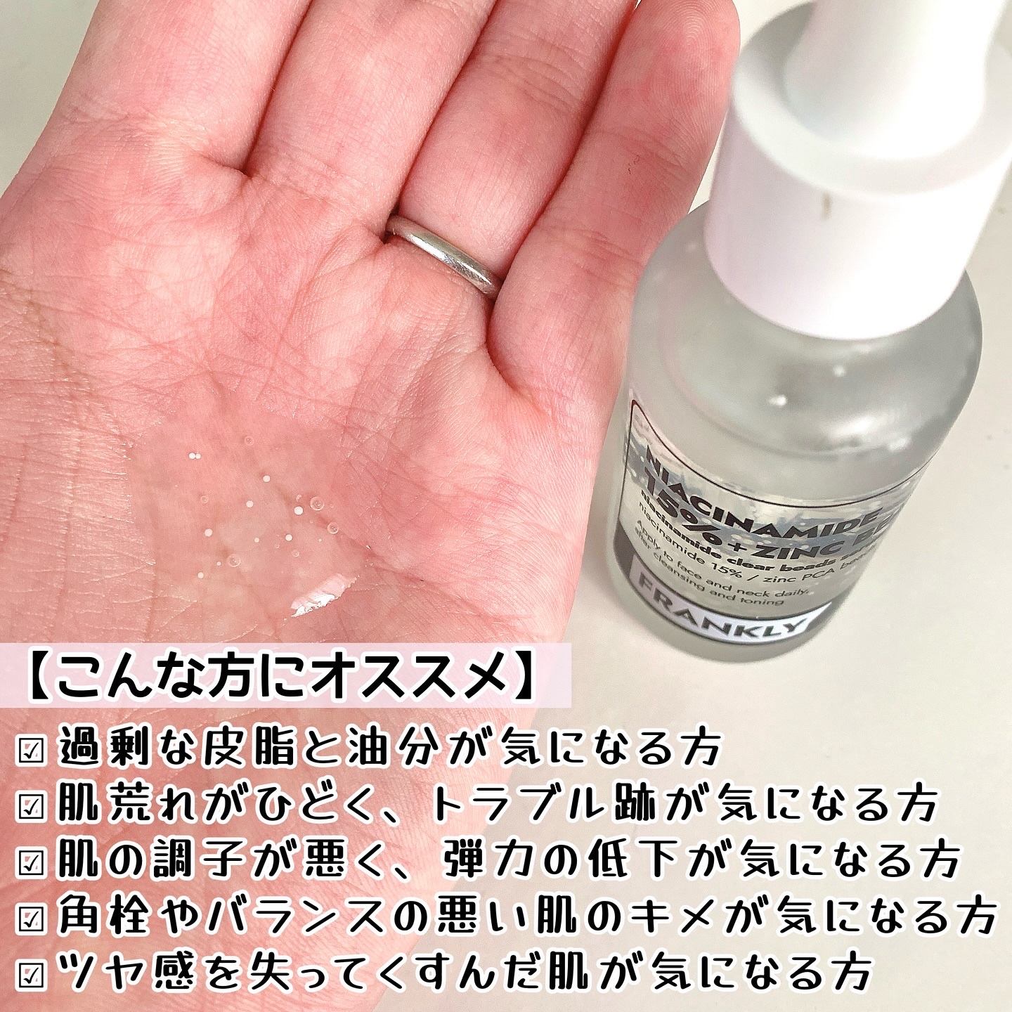 ナイアシンジンクビーズセラム/Frankly/美容液を使ったクチコミ（3枚目）