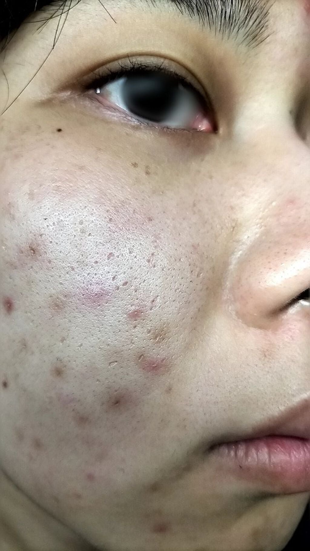 NITENA/LOABI/美顔器・マッサージを使ったクチコミ(3枚目)