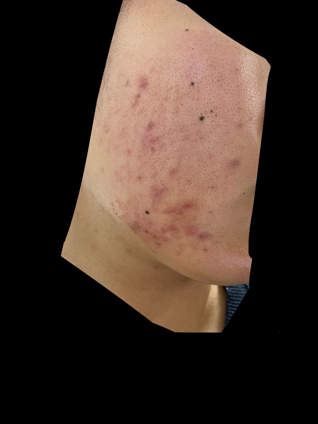 を使ったクチコミ（3枚目）