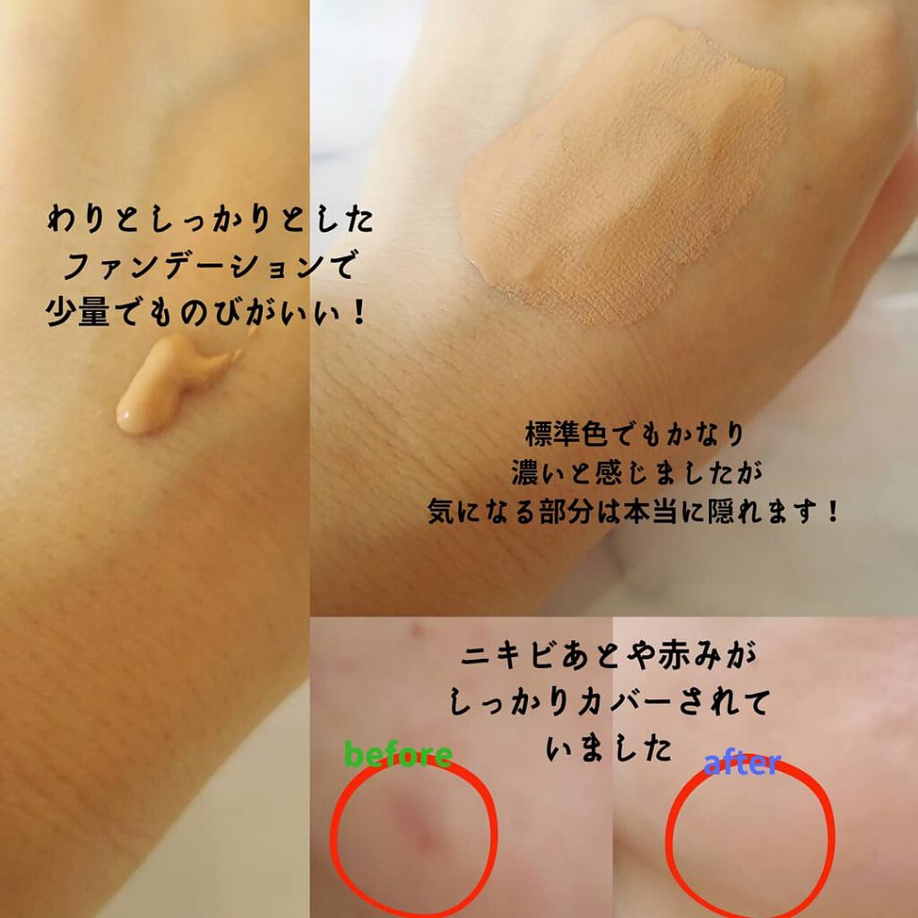 スキンカラーコントロール/ACSEINE/クリームコンシーラーを使ったクチコミ(3枚目)