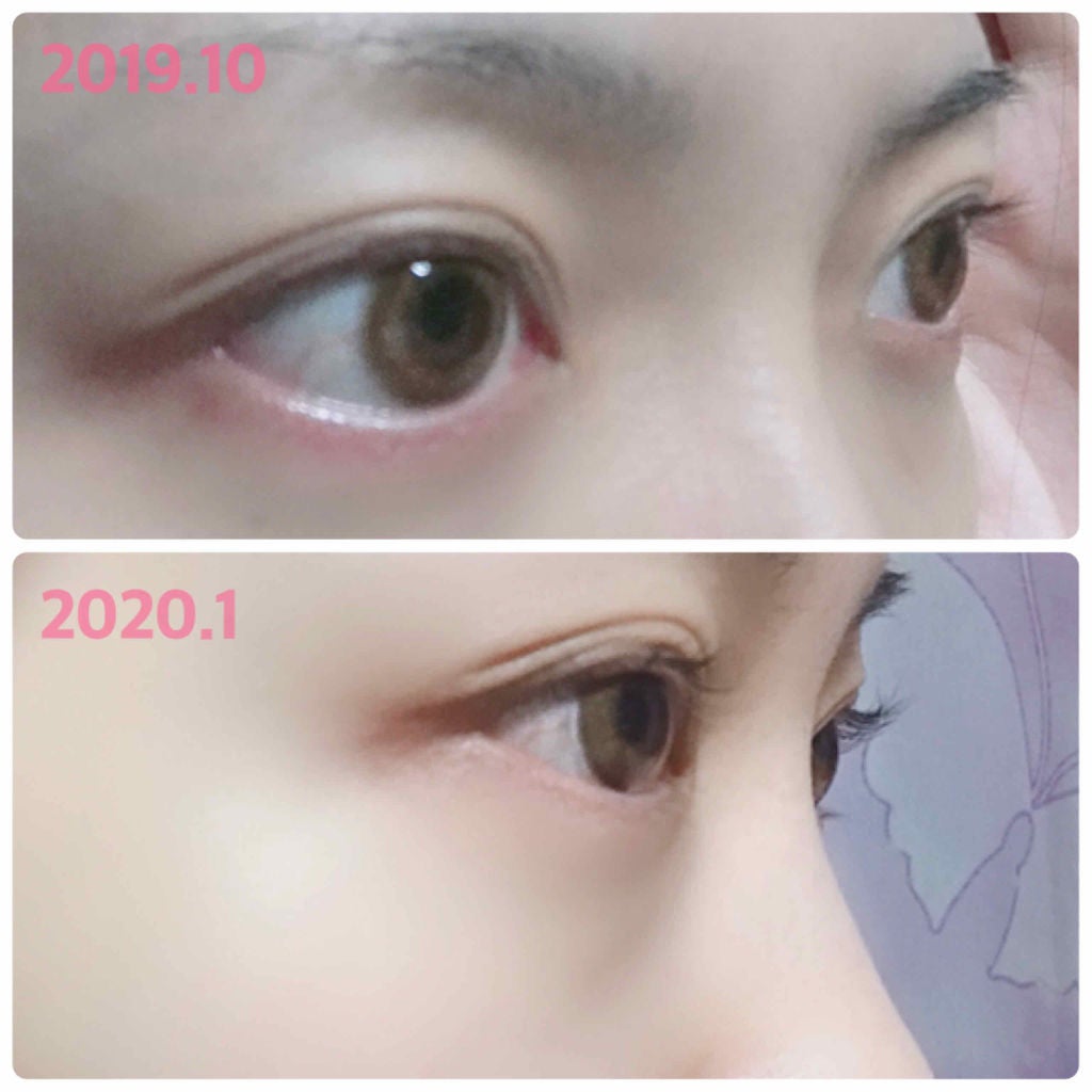 げんちゃん❤︎フォロバ100% on LIPS 「まつ毛美容液ケアプロストのご紹介です🥰4ヶ月間使ってみて効果を..」(2枚目)