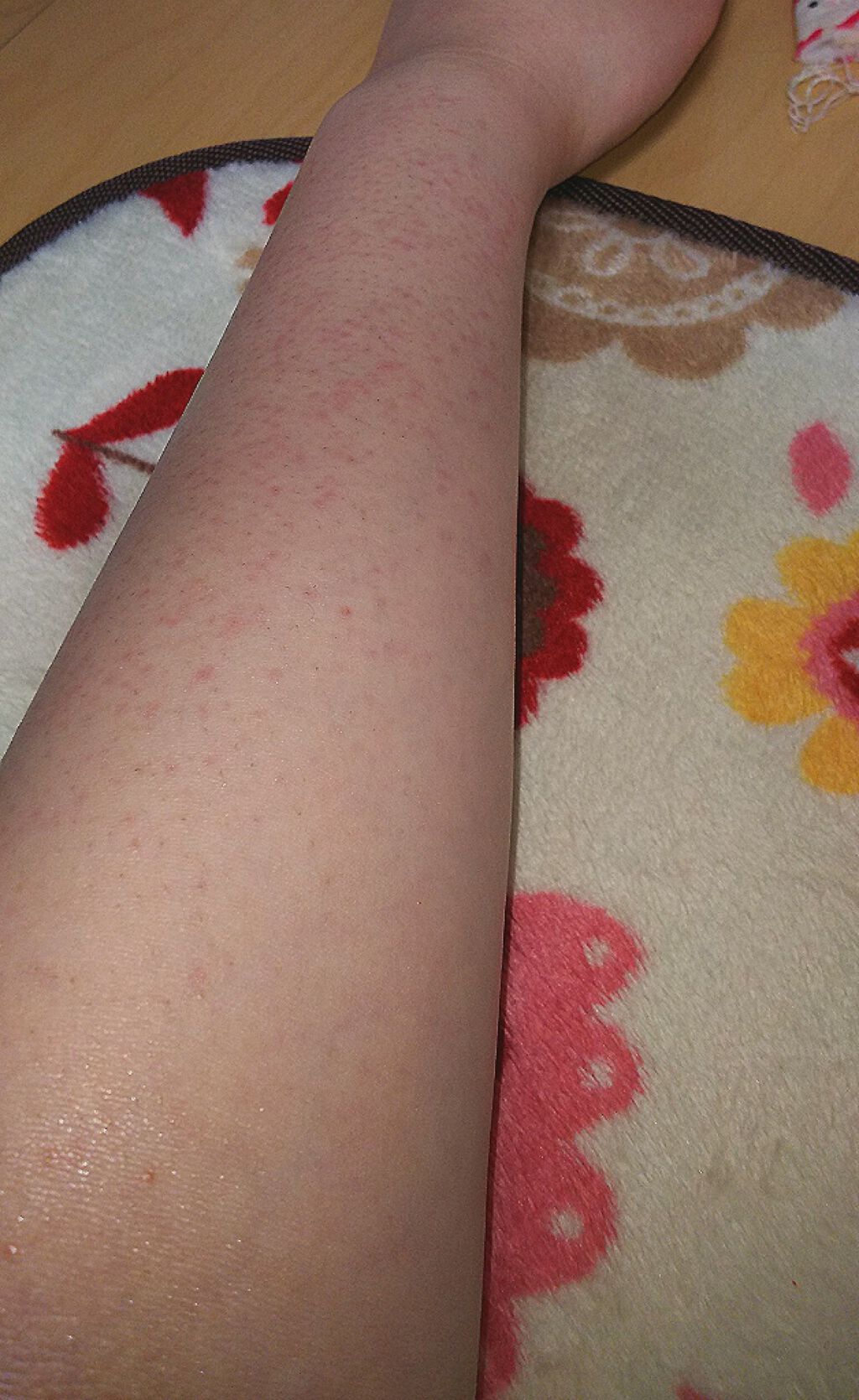 除毛クリーム ジャスミンハニー/スリンキータッチ セルフスパ/除毛クリームを使ったクチコミ（1枚目）