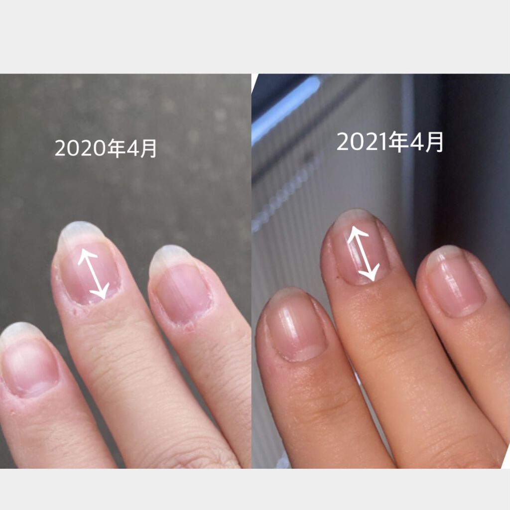 仮定する 規則性 こする ヴァセリン 爪 Telmin Jp 仮定する 規則性 こする ヴァセリン 爪 Telmin Jp