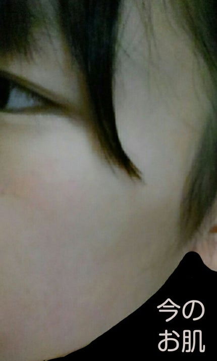 ルルルンピュア エブリーズ/ルルルン/シートマスク・パックを使ったクチコミ(2枚目)