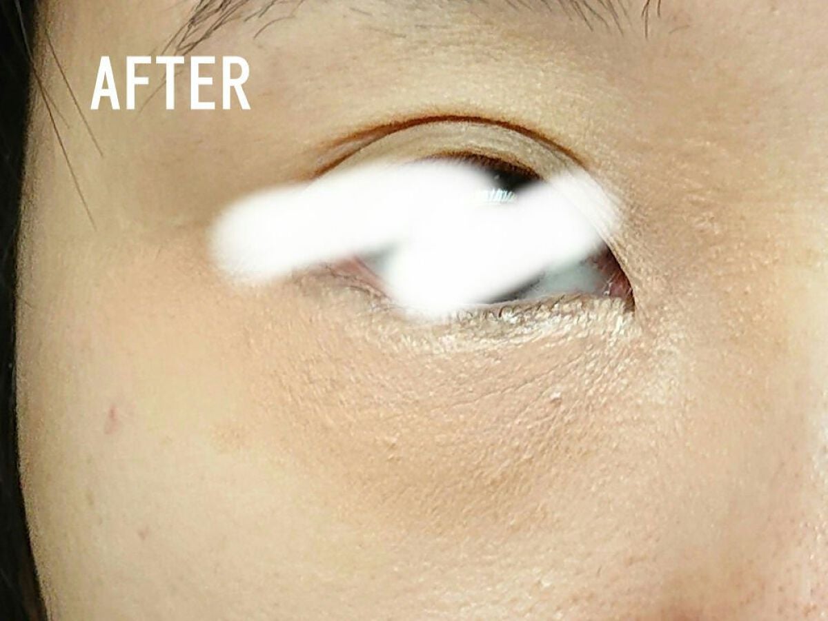 ストレッチコンシーラー/CEZANNE/リキッドコンシーラーを使ったクチコミ(6枚目)