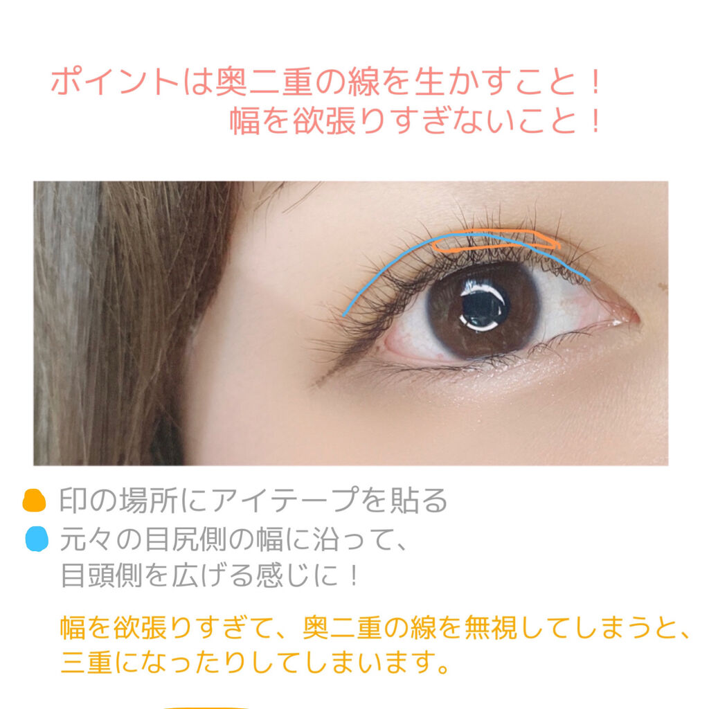 ふたえテープ 目立たず肌になじむ絆創膏タイプ/DAISO/二重まぶた用アイテムを使ったクチコミ（2枚目）