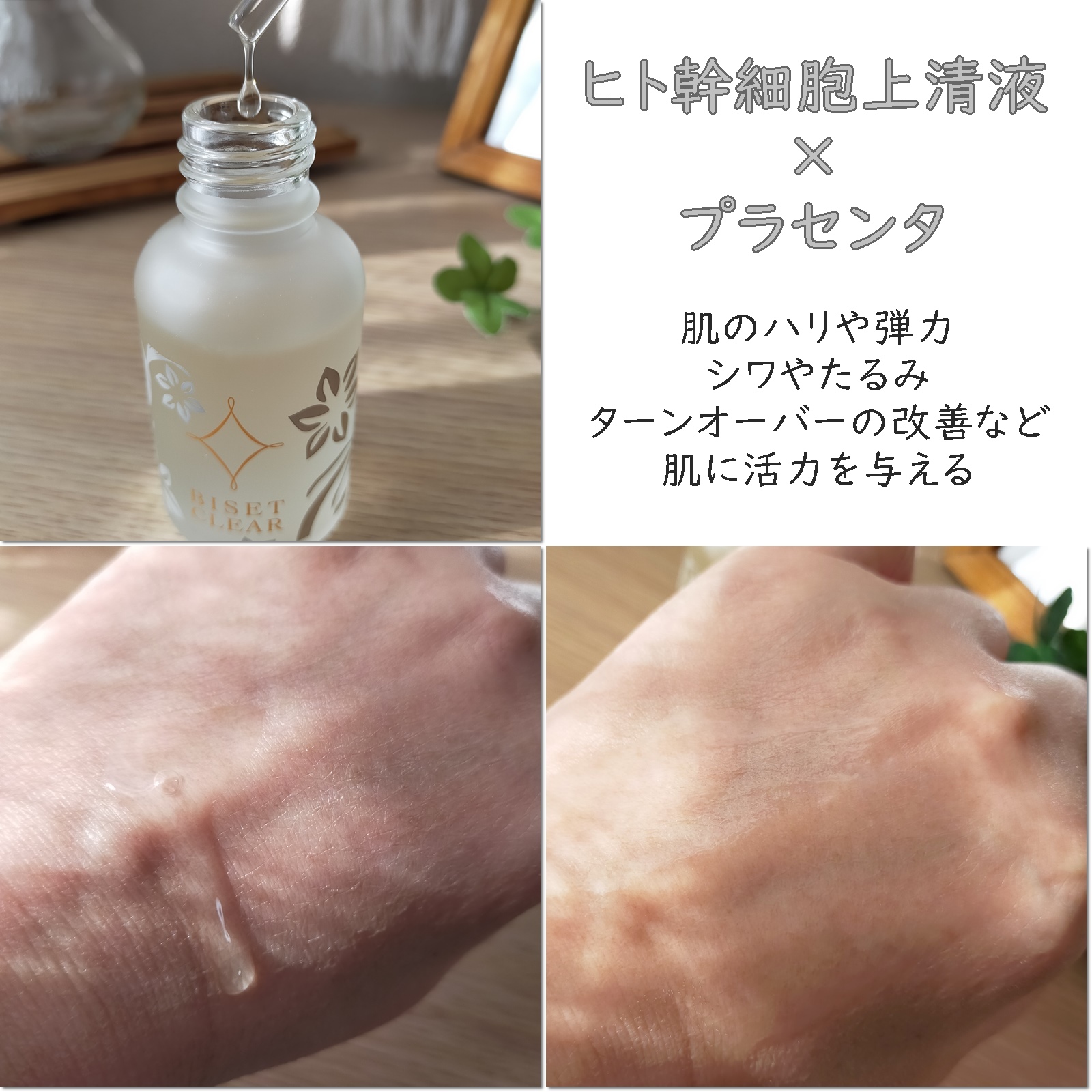 ビセットクリア/BISET/美容液を使ったクチコミ（2枚目）