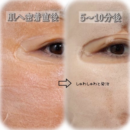 OSEQUE DUAL SKINCARE BUBBLE MASK/OSEQUE/シートマスク・パックを使ったクチコミ(3枚目)