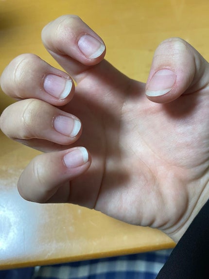 ポニキウムオイル/enieni /ネイルオイル・トリートメントを使ったクチコミ(4枚目)