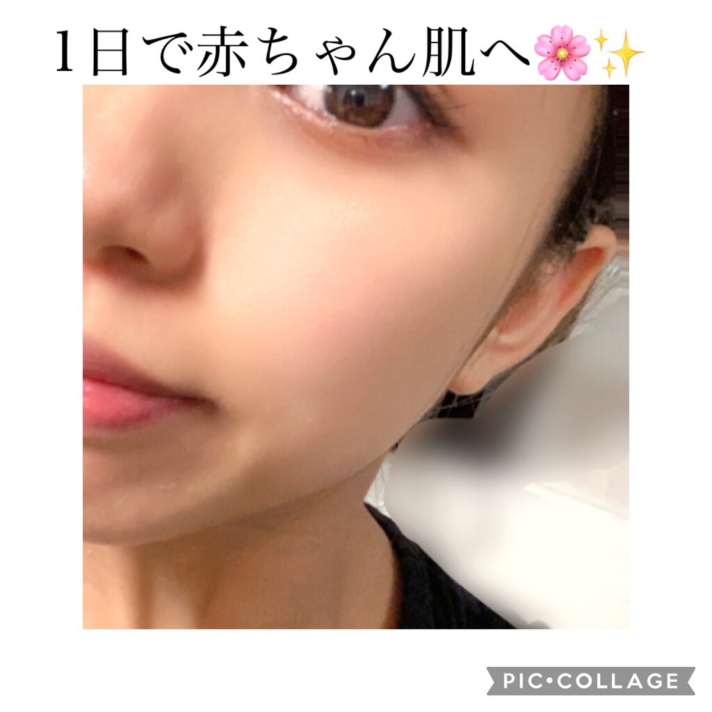 ももぷり フレッシュピールオフパック/ももぷり/ピーリングを使ったクチコミ（1枚目）