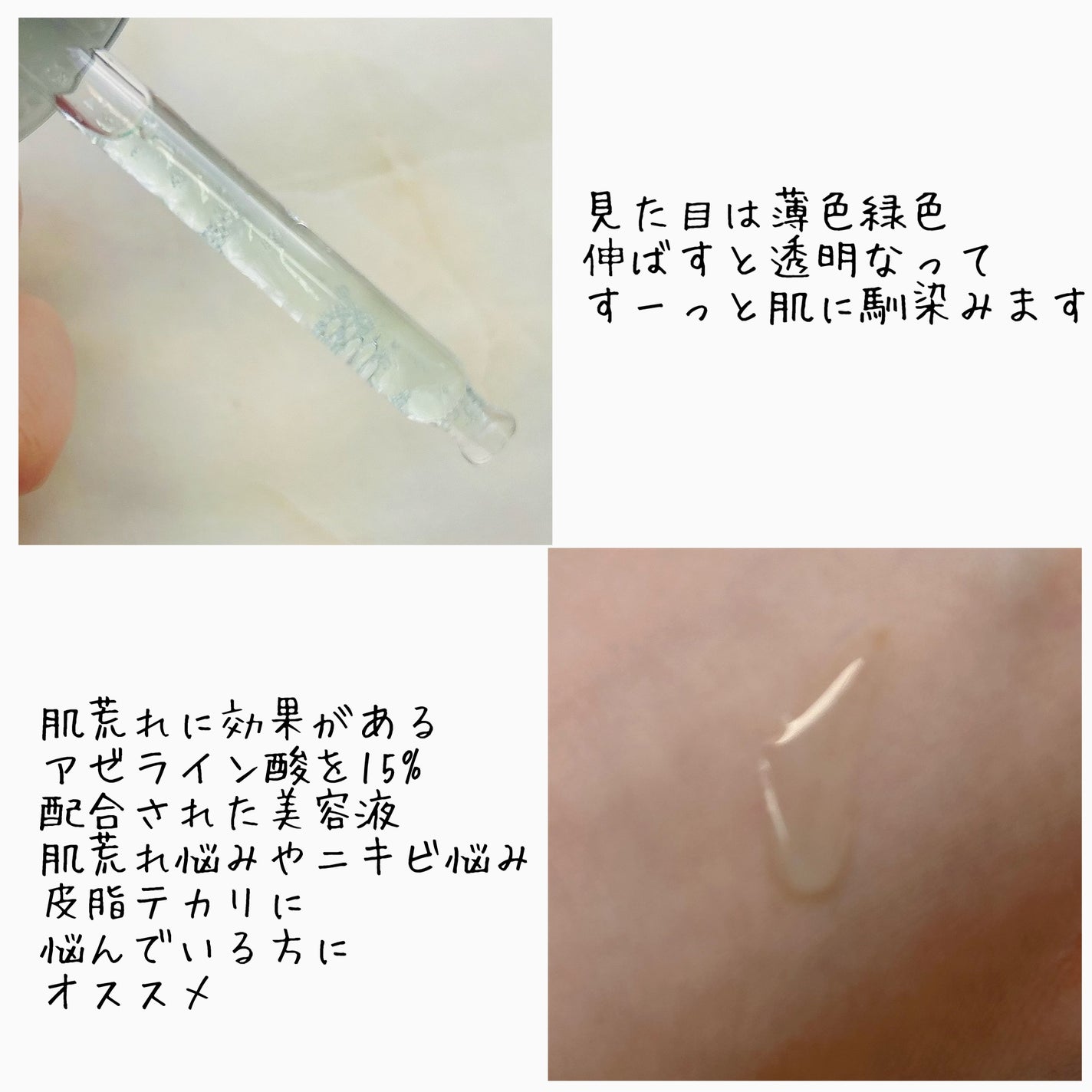 アゼライン酸15 インテンスカーミングセラム/Anua/美容液を使ったクチコミ(2枚目)