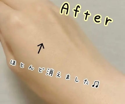 スポッツカバー ファウンデイション/SHISEIDO/クリームコンシーラーを使ったクチコミ(5枚目)