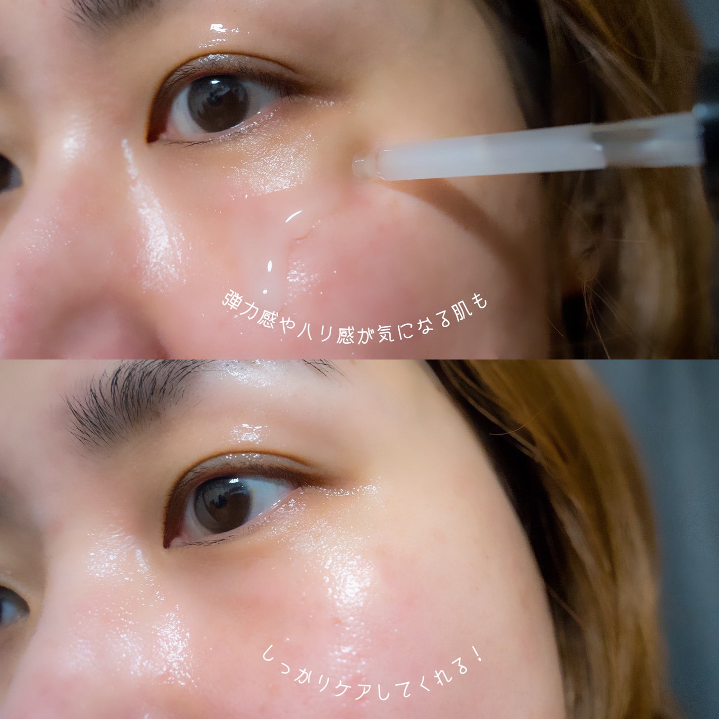 ダーマアンサー PDRN アクティブブースト1:1アンプル/CNP Laboratory/美容液を使ったクチコミ(4枚目)