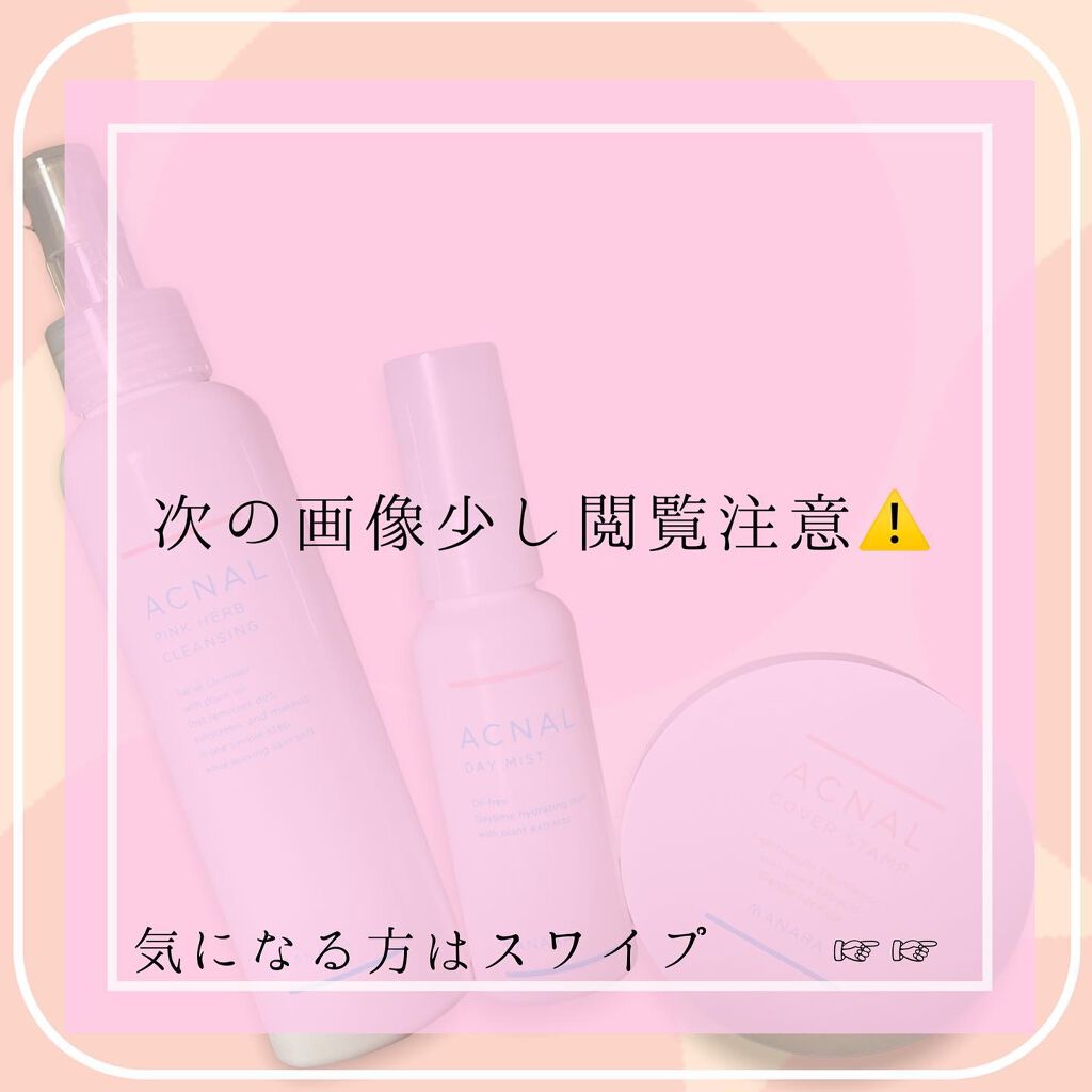 ピンクハーブクレンジング|ACNAL他、2商品を使った口コミ - 角栓 ピンクハーブクレンジング|ACNAL他、2商品を使った口コミ - 角栓