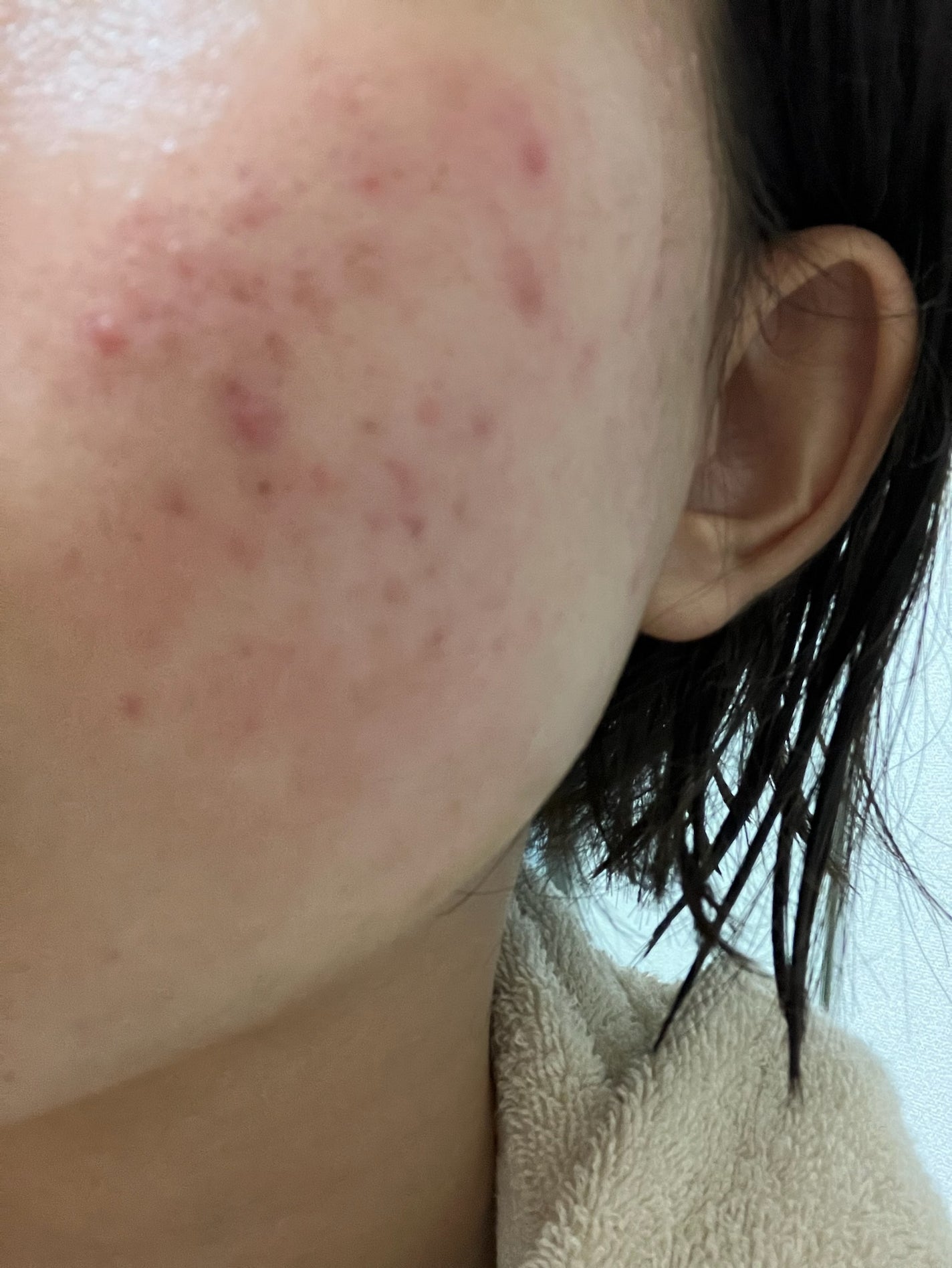 薬用保湿化粧水/オードムーゲ/化粧水を使ったクチコミ(4枚目)