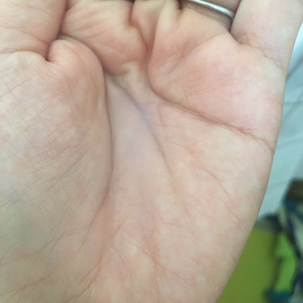 ハトムギエキス化粧水/プラチナレーベル/化粧水を使ったクチコミ(3枚目)