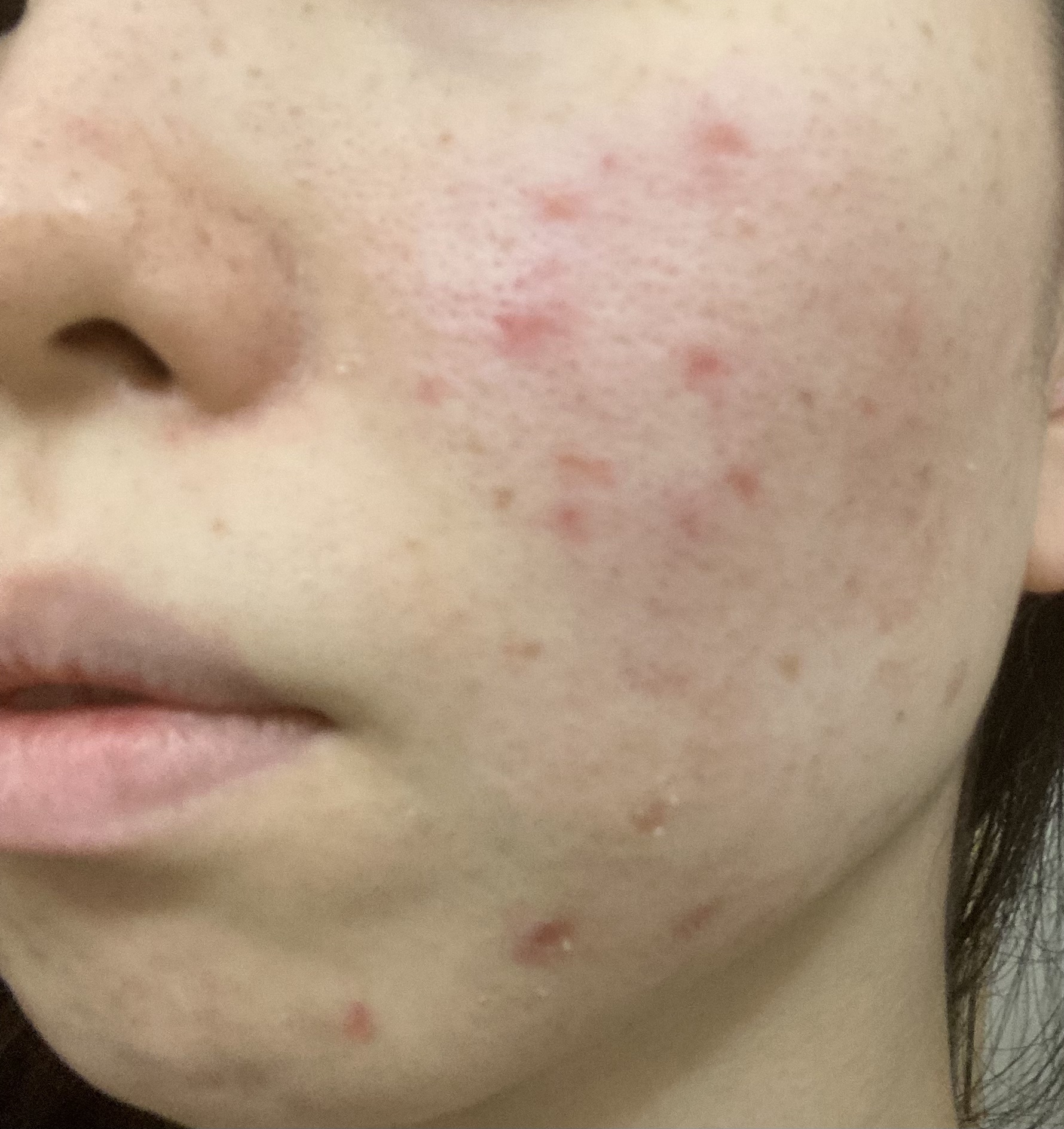 ザ・タイムR アクア/IPSA/化粧水を使ったクチコミ（1枚目）