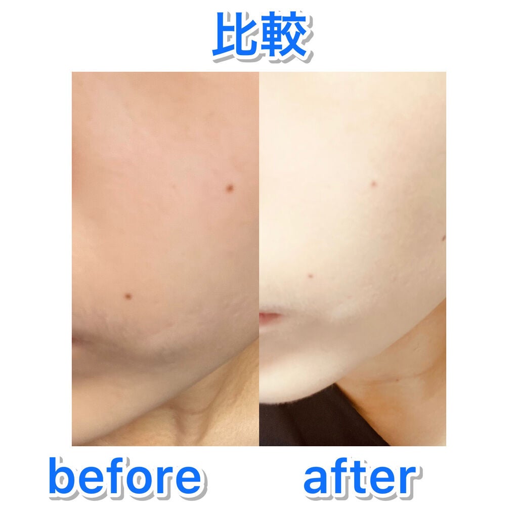 Wエッセンス/shimaboshi/美容液を使ったクチコミ(6枚目)