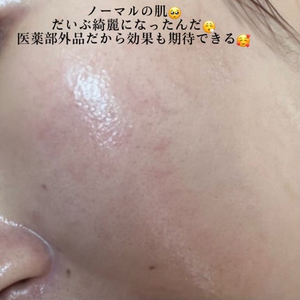 薬用 しみ 集中対策 美容液/メラノCC/美容液を使ったクチコミ(3枚目)