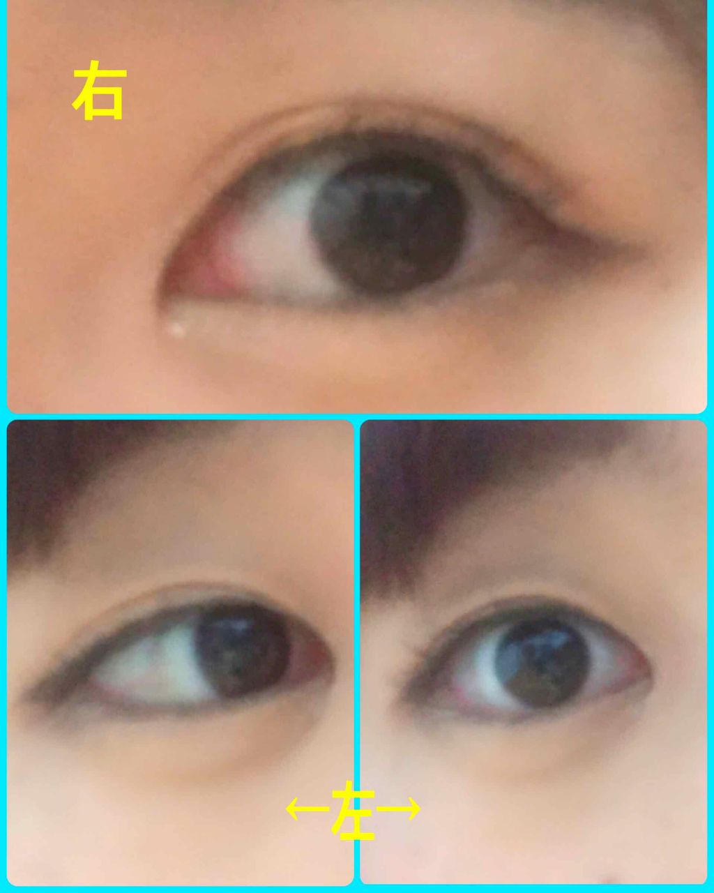 ルドゥーブル/ルドゥーブル/二重まぶた用アイテムを使ったクチコミ（2枚目）