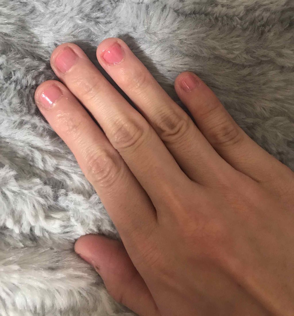 ぬこちゃん on LIPS 「⚠️2枚目、3枚目かなりひどい深爪なのでグロ注意です⚠️[深爪..」(2枚目)
