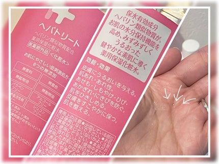 ヘパトリート 薬用保湿化粧水/ゼトックスタイル/化粧水を使ったクチコミ(2枚目)