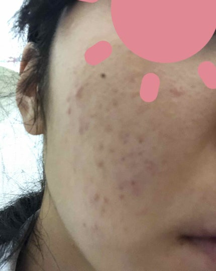 敏感肌用薬用美白美容液/無印良品/美容液を使ったクチコミ(2枚目)