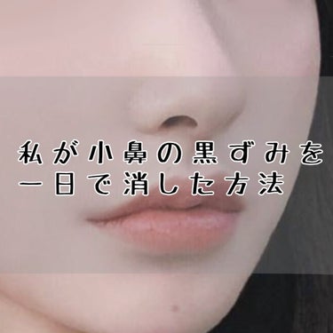 🥛初投稿🥛




皆さん小鼻の黒ずみ大丈夫ですか！？
大丈夫じゃないです(私は)




いるもの

・ホットタオル
・綿棒(無くても良い
・ベビーオイル(スギ薬局で800円くらい
・洗顔料(私はニキ