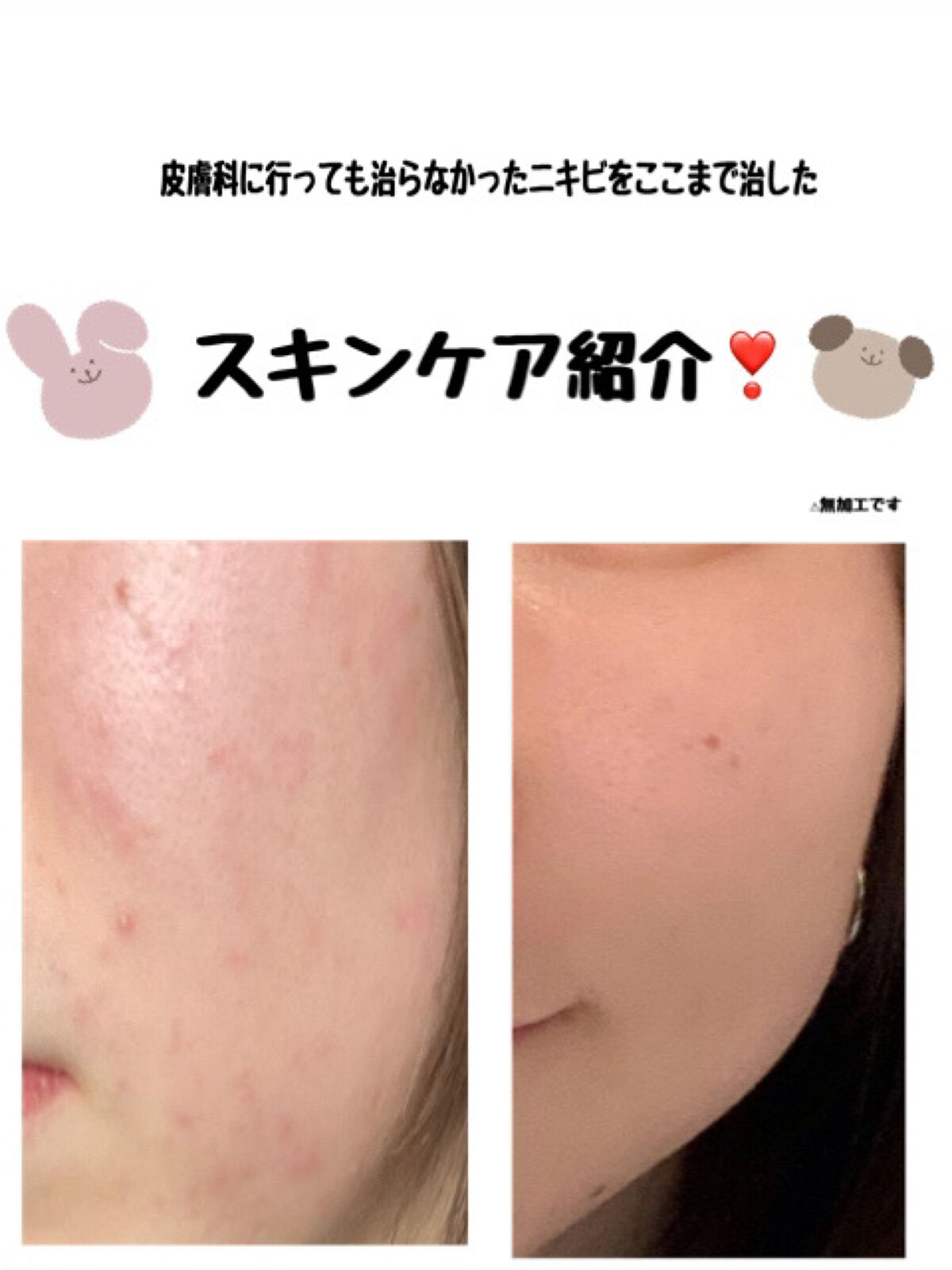 マイルドクレンジング オイル/ファンケル/オイルクレンジングを使ったクチコミ（1枚目）