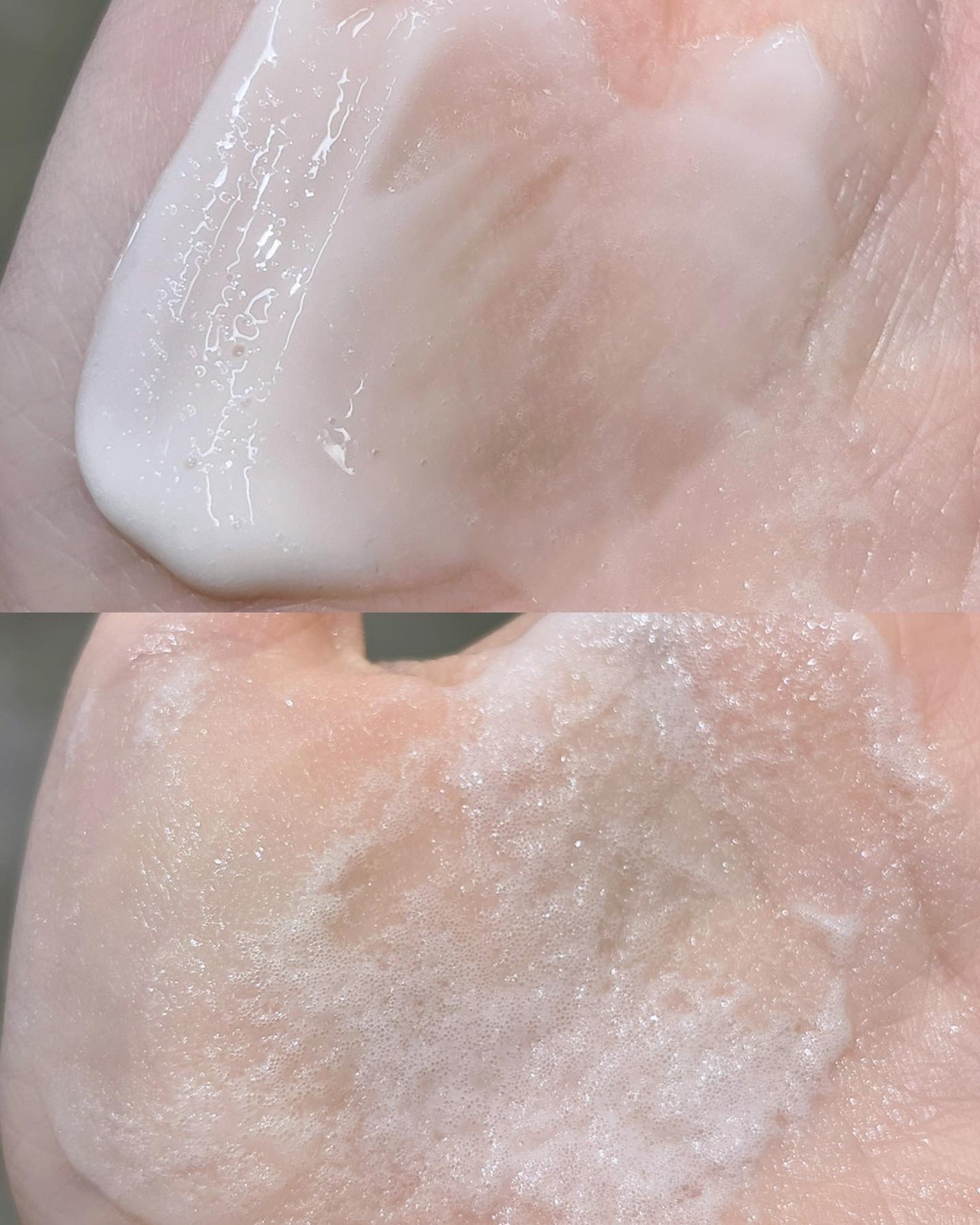 ペプチド ボリューム マスター エッセンス/DR.PEPTI/美容液を使ったクチコミ(8枚目)