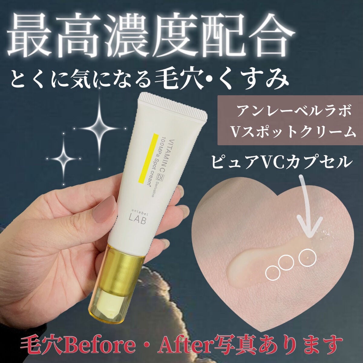 V スポットクリーム /unlabel/フェイスクリームを使ったクチコミ(1枚目)