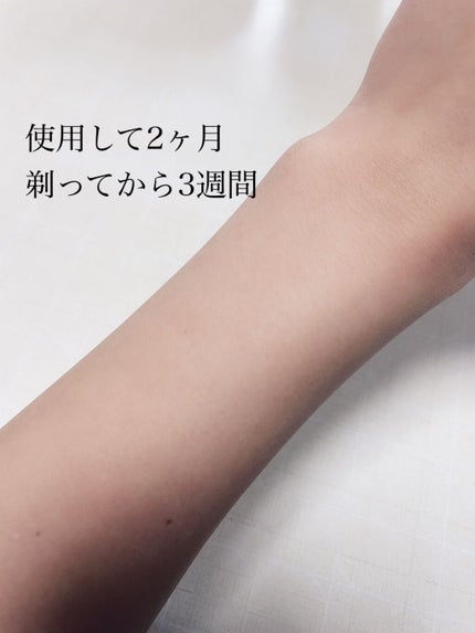 試してみた】アイスレディ iceladyのリアルな口コミ・レビュー 試してみた】アイスレディ iceladyのリアルな口コミ・レビュー