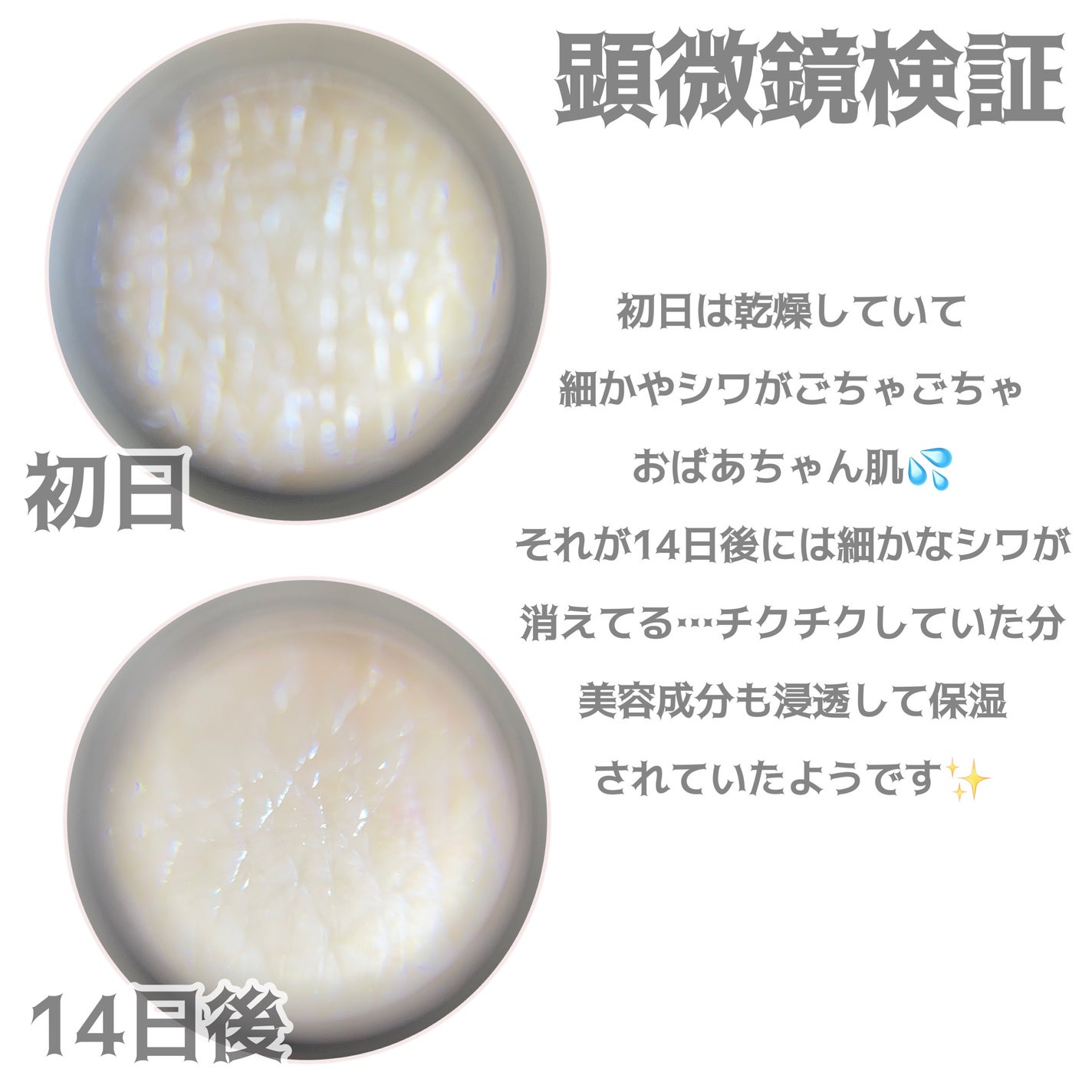 リードルショット100/VT/美容液を使ったクチコミ(5枚目)