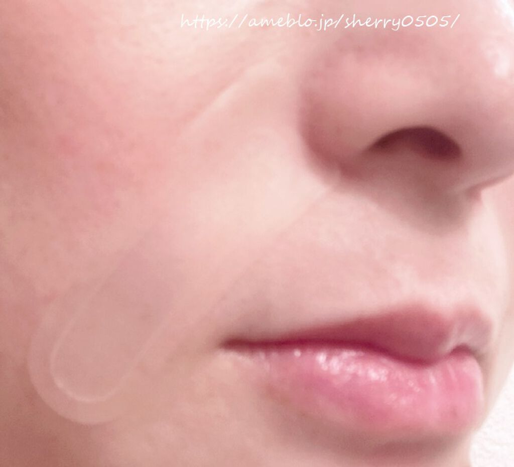 chiyo36 on LIPS 「美容機器で有名なヤーマンさまから、口元用のニードル状美容液が発..」(3枚目)