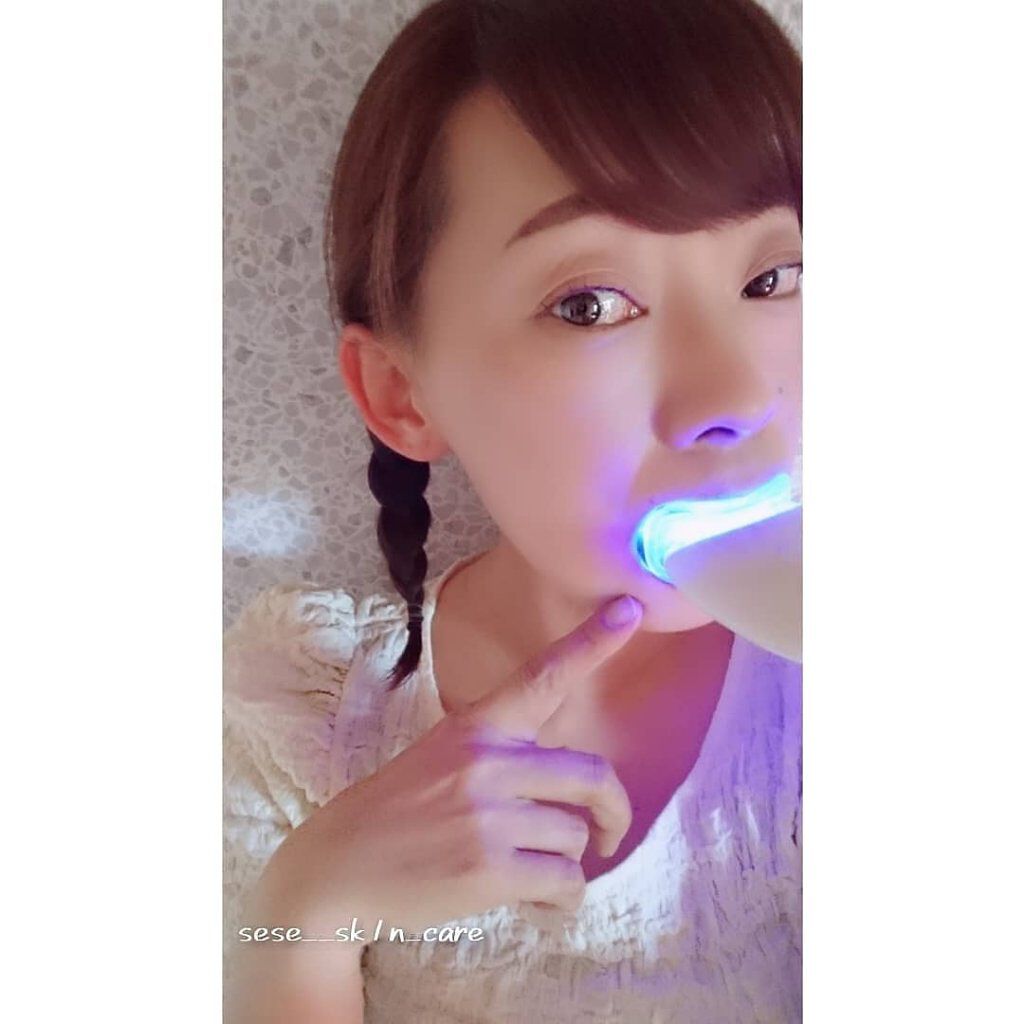 SESE on LIPS 「自宅で楽チンホワイトニング歯医者さんで白くしてもらって1週間し..」(1枚目)