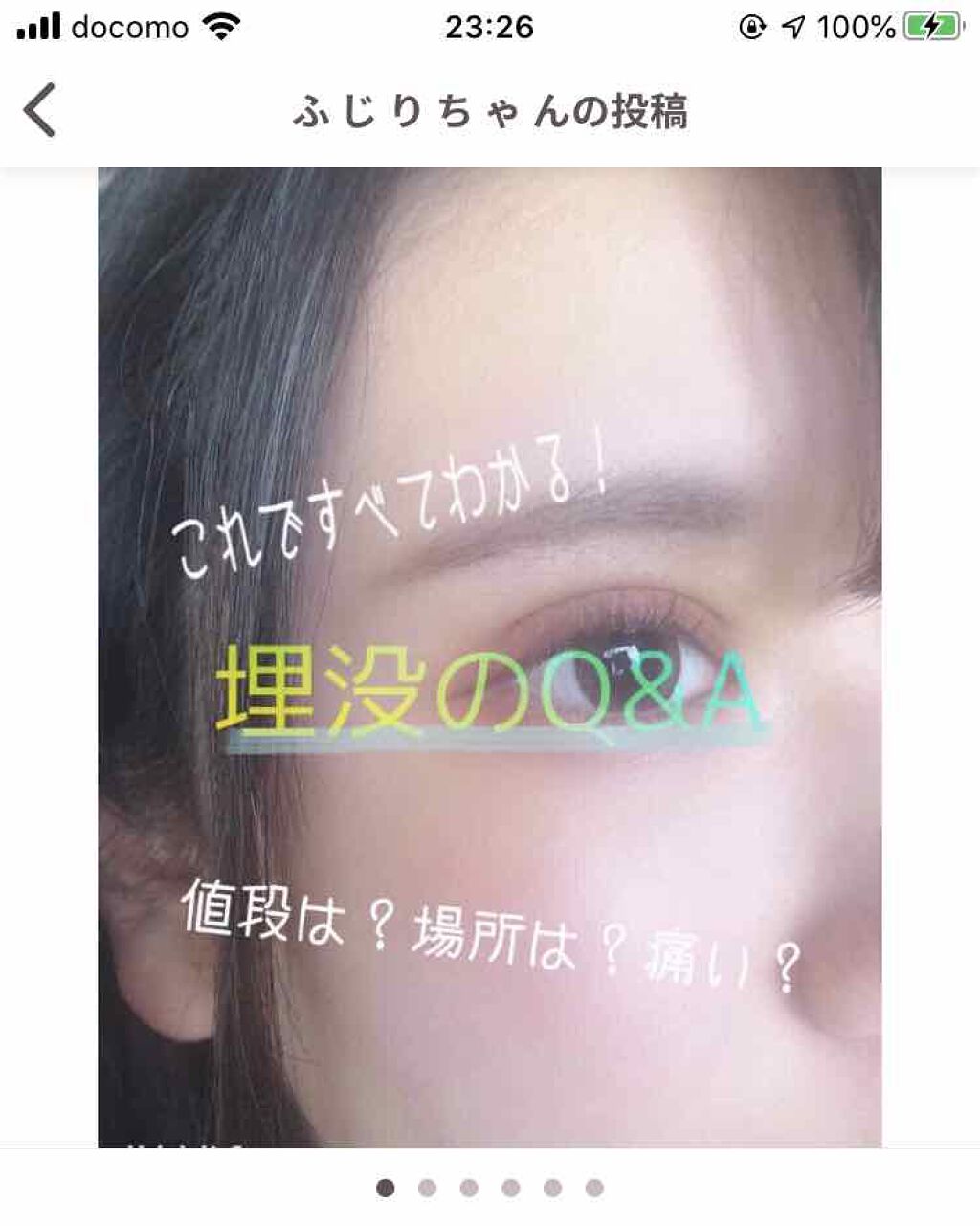 二重整形/その他を使ったクチコミ（1枚目）