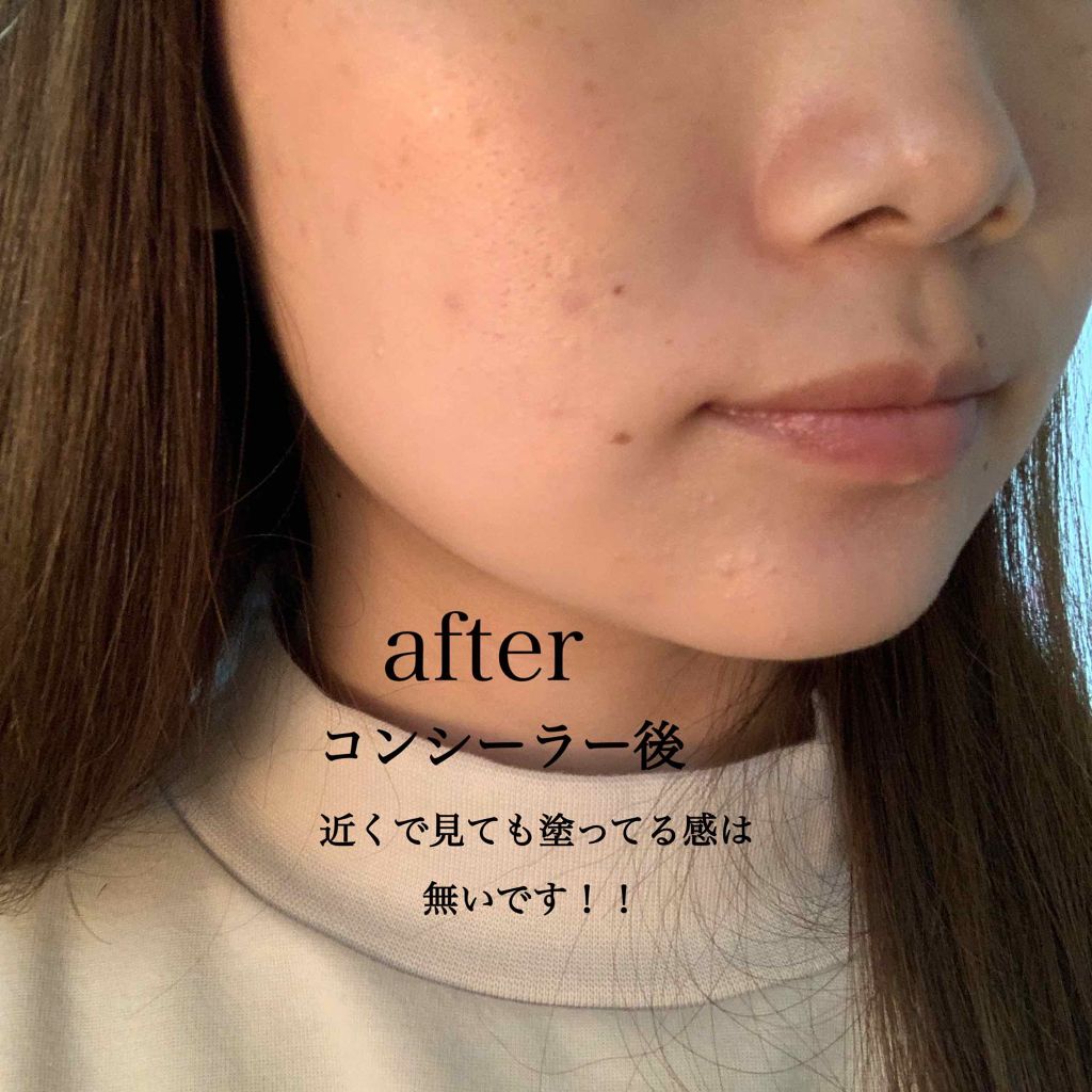 オーガニックスティックコンシーラー/アクア・アクア/スティックコンシーラーを使ったクチコミ(4枚目)