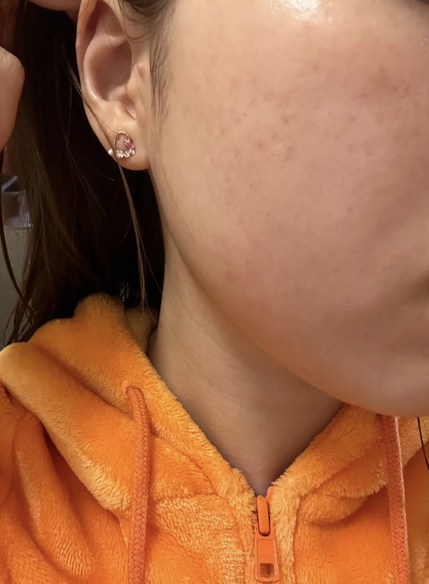 リアルカロテンブレミッシュクリアビタパッド/APRILSKIN/トナーパッドを使ったクチコミ（1枚目）