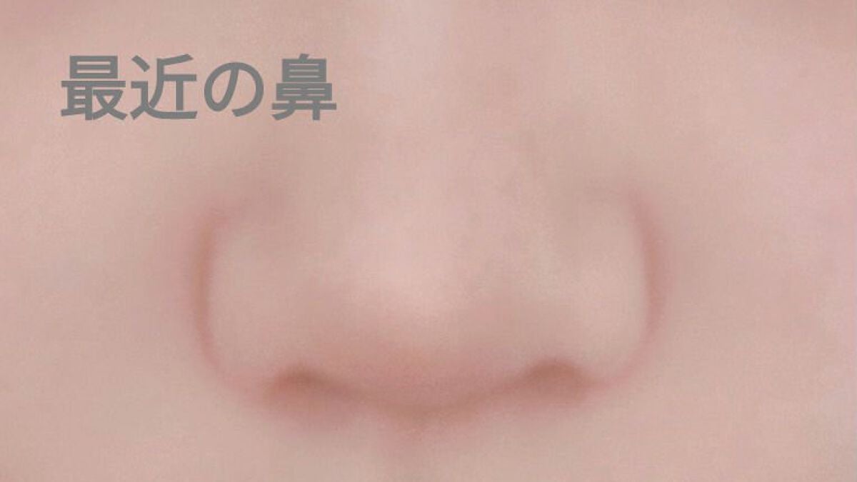 李白 on LIPS 「一年前から鼻マッサージしてます!写真の色がついてるところを両手..」(2枚目)