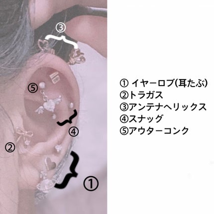 オロナインH軟膏 (医薬品)/オロナイン/その他を使ったクチコミ(2枚目)