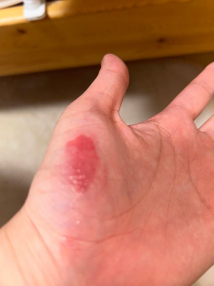 ブラーグロイリップティント/Dinto/リップティントを使ったクチコミ(2枚目)