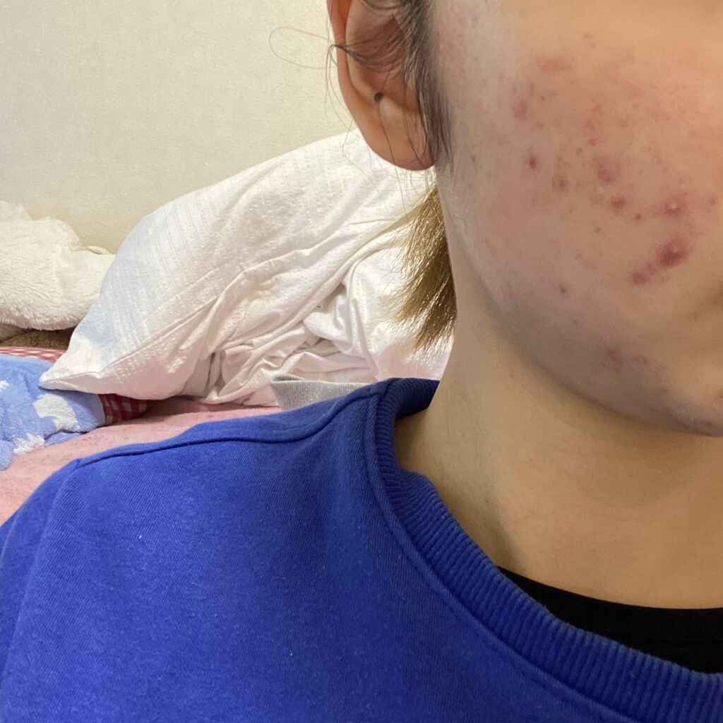 を使ったクチコミ（1枚目）